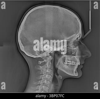 Anatomisches Röntgenbild eines menschlichen Schädels mit detaillierter Struktur von Cranium, Gesichtsknochen und Oberwirbeln für pädagogische und medizinische Erkenntnisse Stockfoto