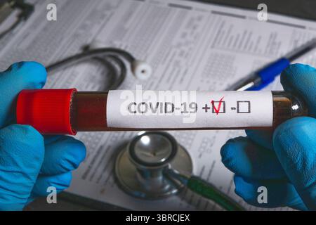 Hände mit Handschuhen, die ein Reagenzglas mit einer Blutprobe halten, die positiv auf covid-19 getestet wurde Stockfoto
