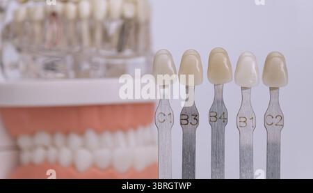 Nahaufnahme einer Zahnfarbführung mit markierten Zahnproben zur Farbwahl in der kosmetischen Zahnheilkunde. Stockfoto