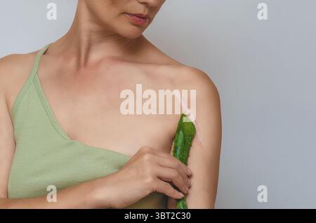 Narbe an der Schulter. Aloe-Blatt weisen auf postoperative Narbe auf der Schulter der Frau hin. Narbenheilung, Behandlung von Narben auf der Haut. Stockfoto