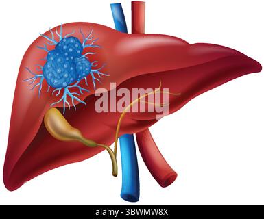 Farbenfrohe Vektorillustration einer menschlichen Leber mit detaillierten anatomischen Merkmalen, die Venen und Gallengang hervorheben Stock Vektor