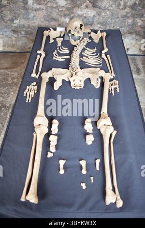 SKE104. London (Vereinigtes Königreich), 28.03.2014.- ein undatiertes Handout von British Crossrail zeigt eines der Skelette, die auf dem Charterhouse Square in Farringdon, London, Großbritannien, entdeckt wurden. 25 Skelette wurden während der Bauarbeiten der Eisenbahnstrecke im März 2013 in diesem Gebiet entdeckt. Nach monatelangen Forschungen hat die DNA gezeigt, dass die Stätte eine Begräbnisstätte für Pestopfer war, die um 1348 errichtet wurde. Die Entdeckung bestätigt die Existenz dieser Notstandspest Black Death Pest, die in historischen Aufzeichnungen als Friedhof für Tausende erwähnt wurde Stockfoto