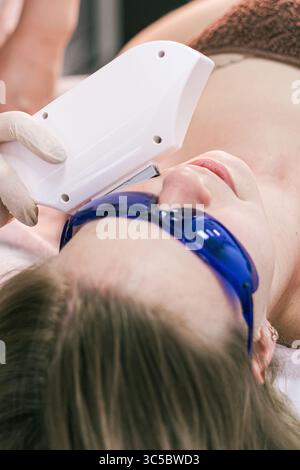 Eine Frau bekommt eine Laserbehandlung im Gesicht. Die Frau trägt eine blaue Schutzbrille und einen weißen Handschuh Stockfoto