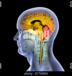 Abbildung einer farbigen Magnetresonanztomographie (MRT) des Gehirns und Halses, die die Anatomie des Zentralnervensystems und die Halswirbelsäule zeigt. Gehirn und Rückenmark sind orange und Kleinhirn rot hervorgehoben. Stockfoto