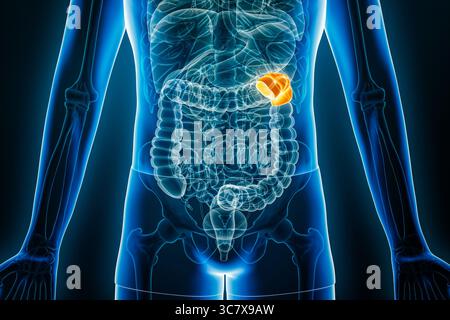 Röntgenologische Vorderansicht der Milz- oder Linksbeugung des menschlichen Kolons 3D-Rendering-Illustration mit männlichen Körperkonturen. Anatomie, Organ des Verdauungssystems Stockfoto
