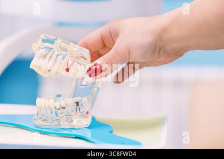 Weibliches Zahnarztmodell mit Hohlräumen. Stockfoto