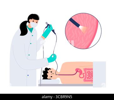 Abbildung einer Gastroskopie, auch als obere Endoskopie bezeichnet. Dies ist ein Verfahren, bei dem ein Endoskop durch den Mund eingeführt wird, um Ösophagus, Magen und Zwölffingerdarm zu untersuchen. Es hilft bei der Diagnose und Behandlung von Erkrankungen wie Geschwüren, Entzündungen oder Tumoren im oberen Verdauungstrakt. Stockfoto