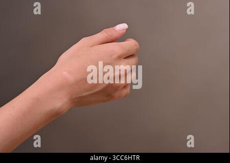 Komplizierte Narbendetails an der Stelle, an der Ganglienzyste entfernt wurde. Kaum wahrnehmbare Narbe stellt einen Triumph über chronische Handgelenkschmerzen nach erfolgreicher Operation dar Stockfoto