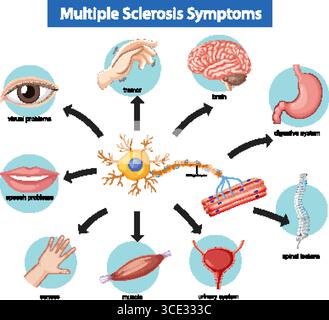 Medizinische Vektor-Illustration, die Symptome der Multiplen Sklerose mit beschrifteten Symbolen für Gehirn, Wirbelsäulenläsionen, Muskel, Sinne und betroffenes Körpersystem zeigt Stock Vektor