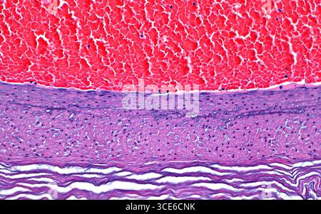 Lichtmikroskop eines Blutgefäßes. Die Wand des Blutgefäßes (in diesem Fall aus einer menschlichen Nabelschnur) ist in der Mitte des Bildes zu sehen und zeigt die mediale Schicht (hell-violett-rosa), bestehend aus glatten Muskeln und der Adventitia (wellige violette Linien), die die äußere Bindegewebsschicht ist. Die obere Bildhälfte ist vom Gefäßlumen besetzt, das rote Blutkörperchen (hellrot) und Leukozyten oder weiße Blutkörperchen (kleine dunkelblaue Punkte) enthält. Hämatoxylin- und Eosin-gefärbter Gewebeschnitt. Vergrößerung: 200-fach bei 10 cm Druck. Stockfoto