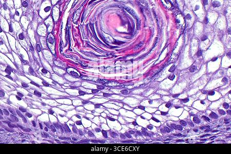 Hodentteratom, Lichtmikrograph Stockfoto