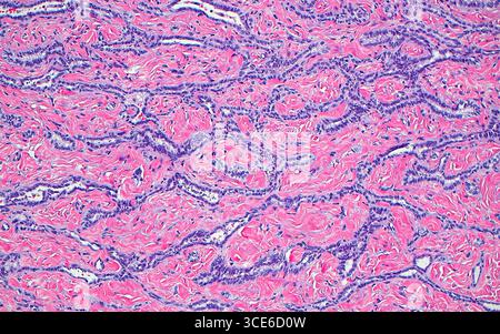 Das Lichtmikroskop des Rete testis. „Rete“ bezieht sich auf eine Struktur, die einem Netz ähnelt, ebenso wie die miteinander verbundenen röhrenförmigen Strukturen (blau-violett) des Rete testis. Die Rete-Tubuli sind im Bindegewebe (rosa) vorhanden. Die Rete testis-Tubuli verbinden die Samenkanälen des Hodens, die Spermien produzieren, mit den ableitenden Kanälen des Nebenhodens, der nächsten Struktur, durch die Spermien durch den männlichen Genitaltrakt transportiert werden. Hämatoxylin- und Eosin-gefärbter Gewebeschnitt. Vergrößerung: 100-fach bei 10 cm Druck. Stockfoto