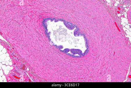 Lichtmikrogramm der Vas deferens, hier im Querschnitt zu sehen. Das Vas deferens trägt Spermien aus dem Hoden und lagert sie in der Harnröhre innerhalb der Prostata ab. Er besteht aus einer Epithelschicht (violett), die sein Lumen auskleidet (weiß, Bildmitte) und aus senkrechten Schichten glatter Muskulatur (rosa), die seine Wand bilden. An den Bildrändern sind auch einige Fettzellen, Bindegewebe und kleine Blutgefäße zu sehen, die außerhalb der Vas deferens Wand vorhanden sind. Hämatoxylin- und Eosin-gefärbter Gewebeschnitt. Vergrößerung: 40-fach bei 10 cm Druck. Stockfoto