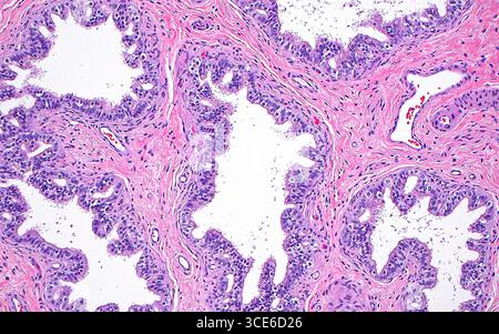 Lichtmikrographie efferenter Ductus. Die efferenten Ductus sind Teil des männlichen Genitaltraktes, durch den Spermien transportiert werden, und verbinden den Rete testis mit dem Kopf des Nebenhodens. Die Kanäle sind von Epithel (violett) um wellige Lumen (weiße Räume) gesäumt. Um die Kanäle herum befindet sich Bindegewebe (rosa), in dem einige Blutgefäße zu sehen sind (weiße Räume mit roten Blutkörperchen, die wie helle rote Punkte aussehen). Hämatoxylin- und Eosin-gefärbter Gewebeschnitt. Vergrößerung: 100-fach bei 10 cm Druck. Stockfoto