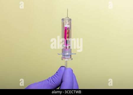 Nahaufnahme der Hände mit Handschuhen, die eine Spritze mit einem durchsichtigen Zylinder und einer lebhaften Flüssigkeit auf einem weichen gelben Hintergrund halten. Perfekt für Medi Stockfoto