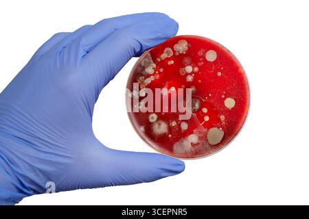 Bakterien- und Schimmelpilzkolonien, die aus der Raumluft auf Blut-Schafagar gewachsen sind, Foto, das die mikrobielle Vielfalt und Luftkontamination zeigt. Stockfoto