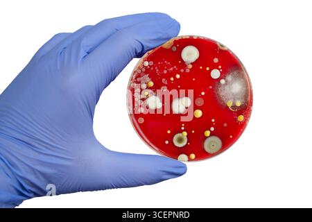 Bakterien- und Schimmelpilzkolonien, die aus der Raumluft auf Blut-Schafagar gewachsen sind, Foto, das die mikrobielle Vielfalt und Luftkontamination zeigt. Stockfoto