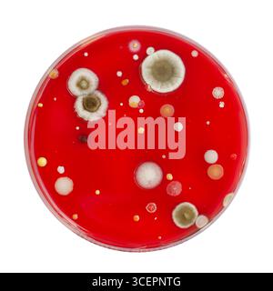 Bakterien- und Schimmelpilzkolonien, die aus der Raumluft auf Blut-Schafagar gewachsen sind, Foto, das die mikrobielle Vielfalt und Luftkontamination zeigt. Stockfoto