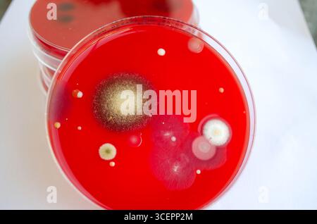 Bakterien- und Schimmelpilzkolonien, die aus der Raumluft auf Blut-Schafagar gewachsen sind, Foto, das die mikrobielle Vielfalt und Luftkontamination zeigt. Stockfoto