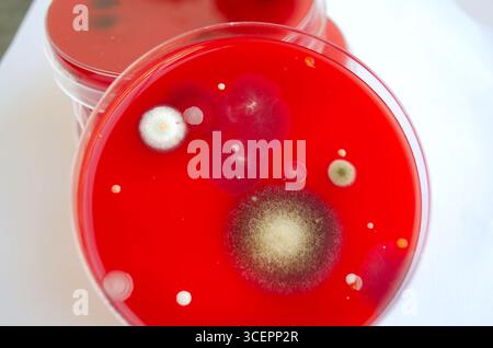 Bakterien- und Schimmelpilzkolonien, die aus der Raumluft auf Blut-Schafagar gewachsen sind, Foto, das die mikrobielle Vielfalt und Luftkontamination zeigt. Stockfoto