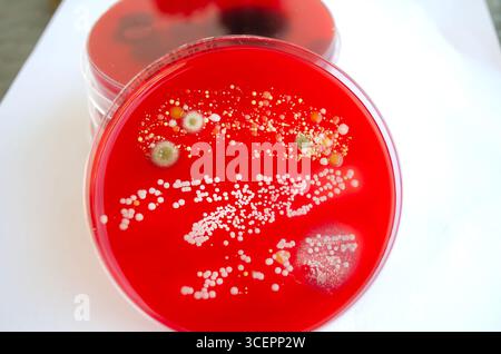 Bakterien- und Schimmelpilzkolonien, die aus der Raumluft auf Blut-Schafagar gewachsen sind, Foto, das die mikrobielle Vielfalt und Luftkontamination zeigt. Stockfoto