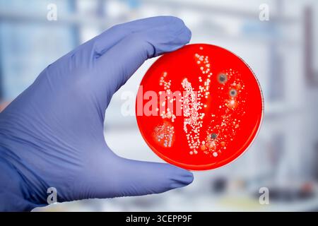 Bakterien- und Schimmelpilzkolonien, die aus der Raumluft auf Blut-Schafagar gewachsen sind, Foto, das die mikrobielle Vielfalt und Luftkontamination zeigt. Stockfoto