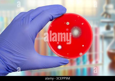 Bakterien- und Schimmelpilzkolonien, die aus der Raumluft auf Blut-Schafagar gewachsen sind, Foto, das die mikrobielle Vielfalt und Luftkontamination zeigt. Stockfoto