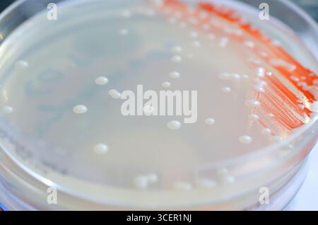 Isolierte Bakterienkolonien auf Kartoffeldextrose-Agar, Foto mit weißen glatten, runden Kolonien mit deckenden Zentren. Stockfoto