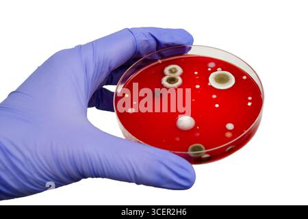 Bakterien- und Schimmelpilzkolonien, die aus der Raumluft auf Blut-Schafagar gewachsen sind, Foto, das die mikrobielle Vielfalt und Luftkontamination zeigt. Stockfoto