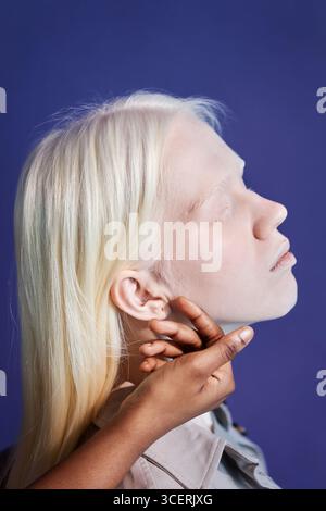 Vertikale Seitenansicht Nahaufnahme einer nicht erkennbaren schwarzen Person leicht berührenden Kiefer einer jungen kaukasischen Frau mit Albinismus Stockfoto