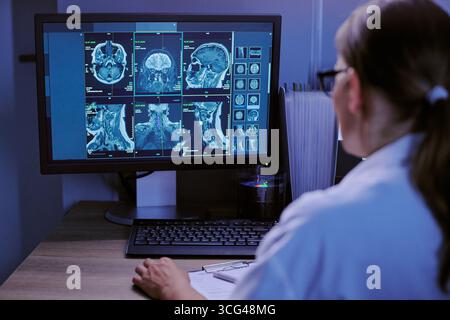 Kaukasische Ärztin analysiert MRT-Aufnahmen von Gehirn und Wirbelsäule auf Computermonitoren Stockfoto