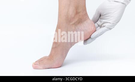 Krampfadern am Bein werden von einem Arzt in einem klinischen Umfeld untersucht, was die Bedeutung von vaskulären Gesundheitsprämienten unterstreicht Stockfoto