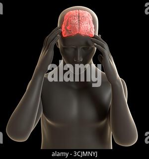 Diese 3D-Abbildung zeigt einen Mann mit Kopfschmerzen Version 2 Stockfoto