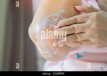 Nahaufnahme einer Frau, die zu Hause unter Schmerzen leidet. Nicht erkennbare Seniorin, die Salbe auf den Ellenbogen aufträgt. Erste medizinische Hilfe zu Hause. Stockfoto