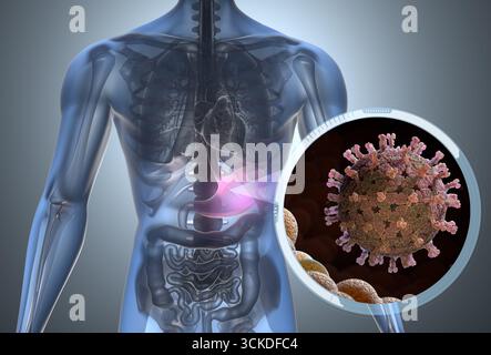 Rotavirusbakterien im Verdauungssystem. 3D-Abbildung Stockfoto