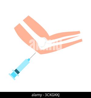 Illustration des Ellbogeninjektionsvektors. Ein Ellenbogen, der eine Injektion erhält. Orthopädisches Behandlungskonzept. Arthritis, Bursitis, Gelenkentzündung, Drainage. Stock Vektor