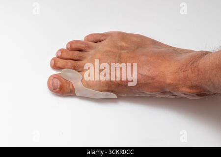 Toe Spacer zur Behandlung und Prophylaxe von Hallux valgus oder Bunion. Männlicher Fuß mit Valgus-Schiene, Silikon-Zehenabstandhalter in Nahaufnahme auf weißem Hintergrund. Stockfoto