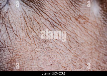 Nahaufnahme der detaillierten Textur trockener Haut Stockfoto