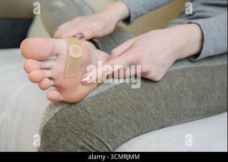 Frau, die Füße mit Schnupfen, Warzen, Corns, Nahaufnahme berührt und dann Pflaster mit Heilmittel aufträgt, um Warze zu beseitigen, Nahaufnahme. Häufige Warze (Verruca vulgaris) ist eine flache Warze am Fuß. Warzenentfernungskonzept Stockfoto