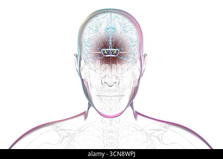Illustration eines menschlichen Gehirns mit degenerierter Substantia nigra bei Morbus Parkinson, der Verlust pigmentierter Nervenzellen im Mittelhirn im Zusammenhang mit motorischer Dysfunktion zeigt. Stockfoto