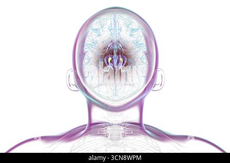 Illustration eines menschlichen Gehirns mit degenerierter Substantia nigra bei Morbus Parkinson, der Verlust pigmentierter Nervenzellen im Mittelhirn im Zusammenhang mit motorischer Dysfunktion zeigt. Stockfoto