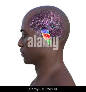Illustration des Hirnstamms im menschlichen Gehirn: Mittelhirn in Blau, Pons in Orange und Medulla oblongata in Grün. Seitenansicht. Stockfoto