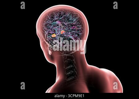 Illustration des menschlichen Gehirns mit hervorgehobener Amygdala. Diese mandelförmige Struktur ist verantwortlich für Emotionsverarbeitung, Angstreaktion und Memo Stockfoto