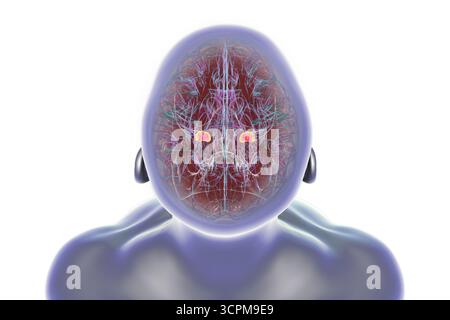 Illustration des menschlichen Gehirns mit hervorgehobener Amygdala. Diese mandelförmige Struktur ist verantwortlich für Emotionsverarbeitung, Angstreaktion und Memo Stockfoto