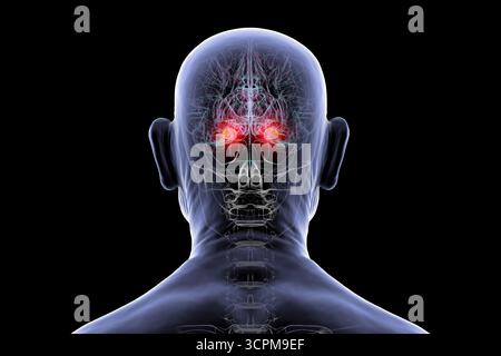 Illustration des menschlichen Gehirns bei einer Seniorin mit hervorgehobener Amygdala. Dies ist eine Schlüsselregion, die mit Emotionen, Gedächtnis und altersbedingten Störungen in Verbindung steht Stockfoto