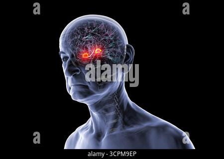 Illustration des menschlichen Gehirns bei einer Seniorin mit hervorgehobener Amygdala. Dies ist eine Schlüsselregion, die mit Emotionen, Gedächtnis und altersbedingten Störungen in Verbindung steht Stockfoto
