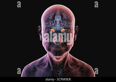 Illustration des menschlichen Gehirns bei einer Seniorin mit hervorgehobener Amygdala. Dies ist eine Schlüsselregion, die mit Emotionen, Gedächtnis und altersbedingten Störungen in Verbindung steht Stockfoto
