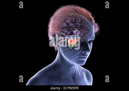 Illustration eines menschlichen Gehirns mit hervorgehobenem Hirnstamm: Mittelhirn in Blau, Pons in Orange und Medulla oblongata in Grün. Stockfoto