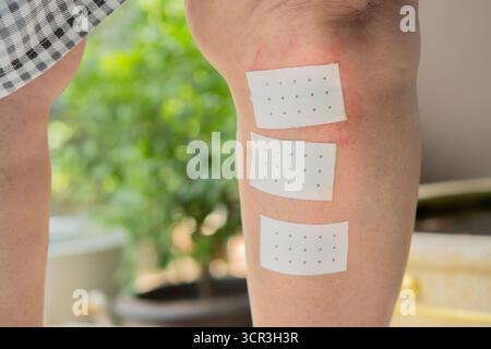 Kinesiologie-Weißband am alten menschlichen Bein im Freien. Lösung bei Bein- und Beinschmerzen. Medizinisches Entlastungskonzept. Stockfoto