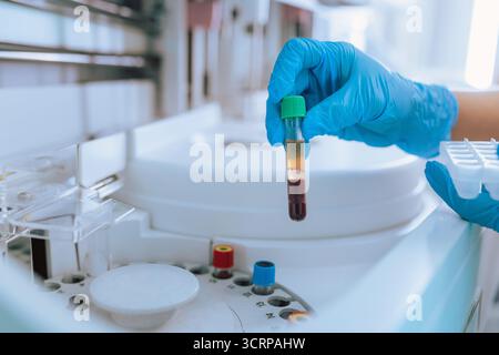 Labortechnikerin, die Reagenzgläser mit Blutproben in einem biochemischen Zentrifugenanalysator platziert. Wissenschaft und Medizin. Stockfoto